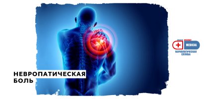 Невропатическая боль.jpg Невропатическая боль.jpg