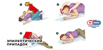 Эпилептический припадок.jpg Эпилептический припадок.jpg
