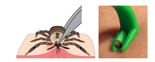 1.png 1.png