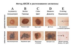 авс.jpg авс.jpg