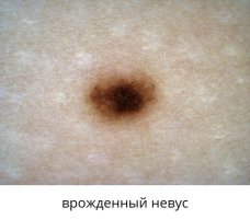 род1.jpg род1.jpg